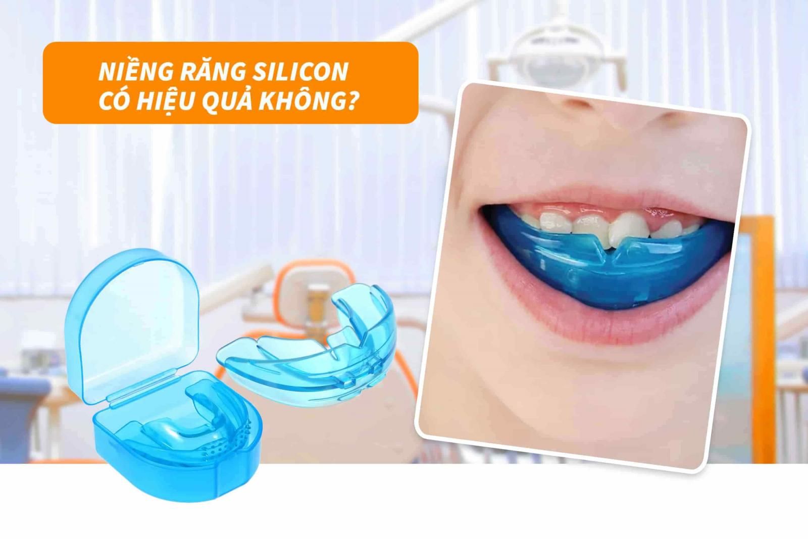 Niềng răng silicon có hiệu quả không?