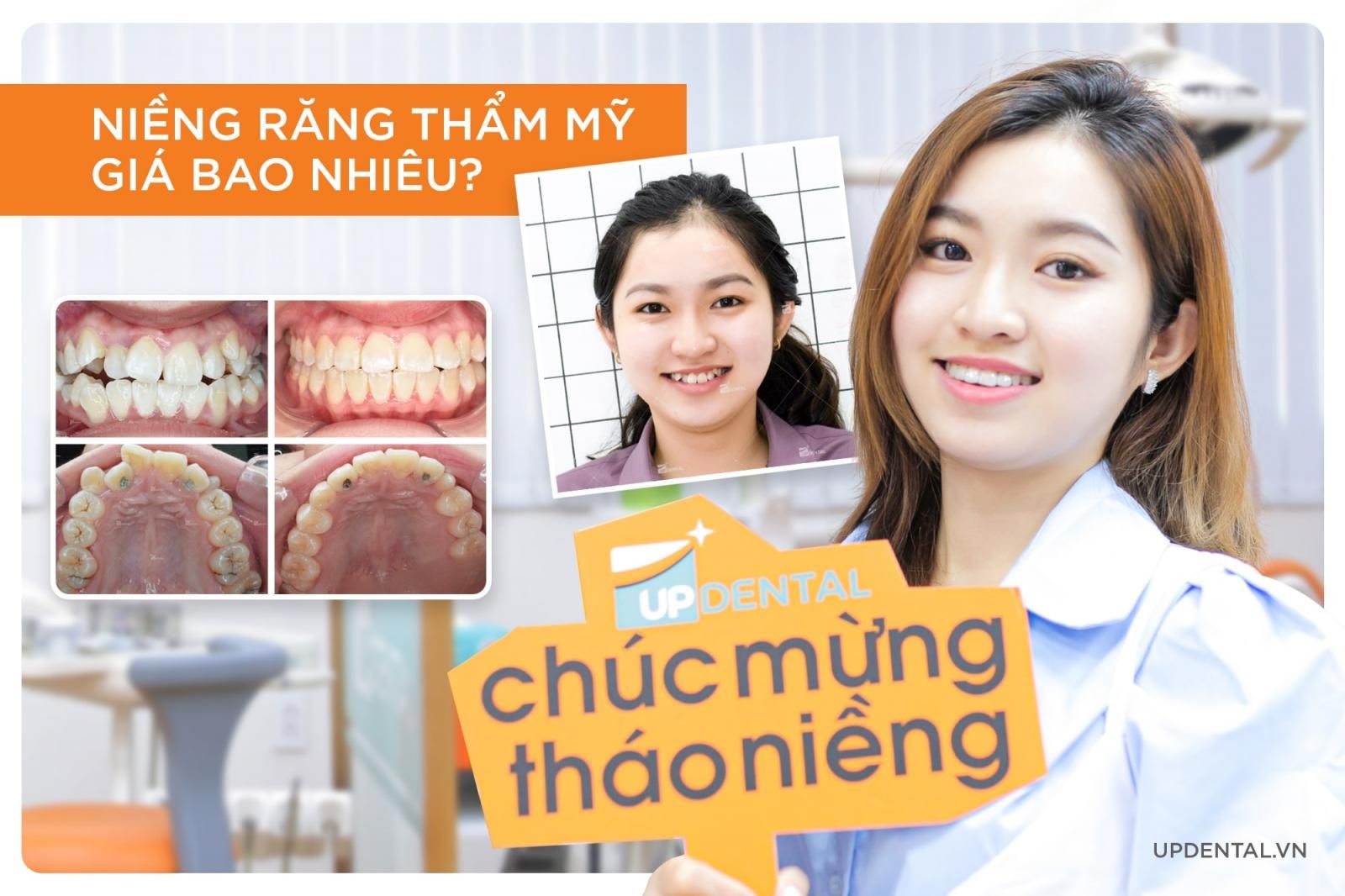 niềng răng thẩm mỹ giá bao nhiêu