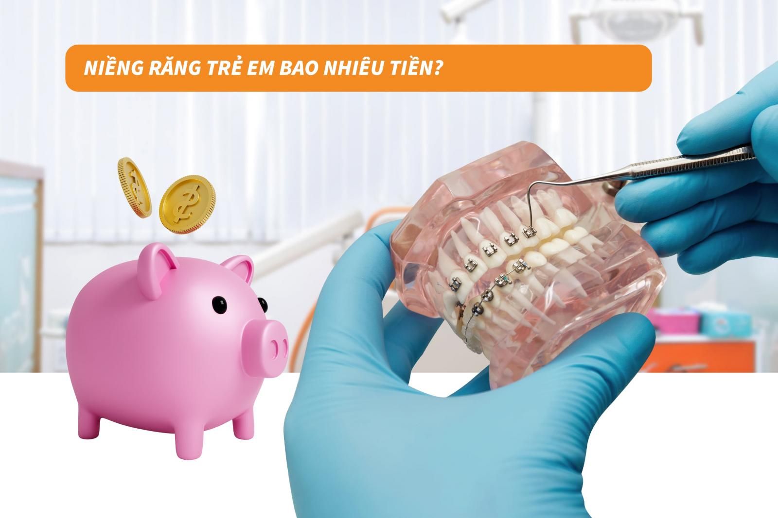 Niềng răng trẻ em bao nhiêu tiền?