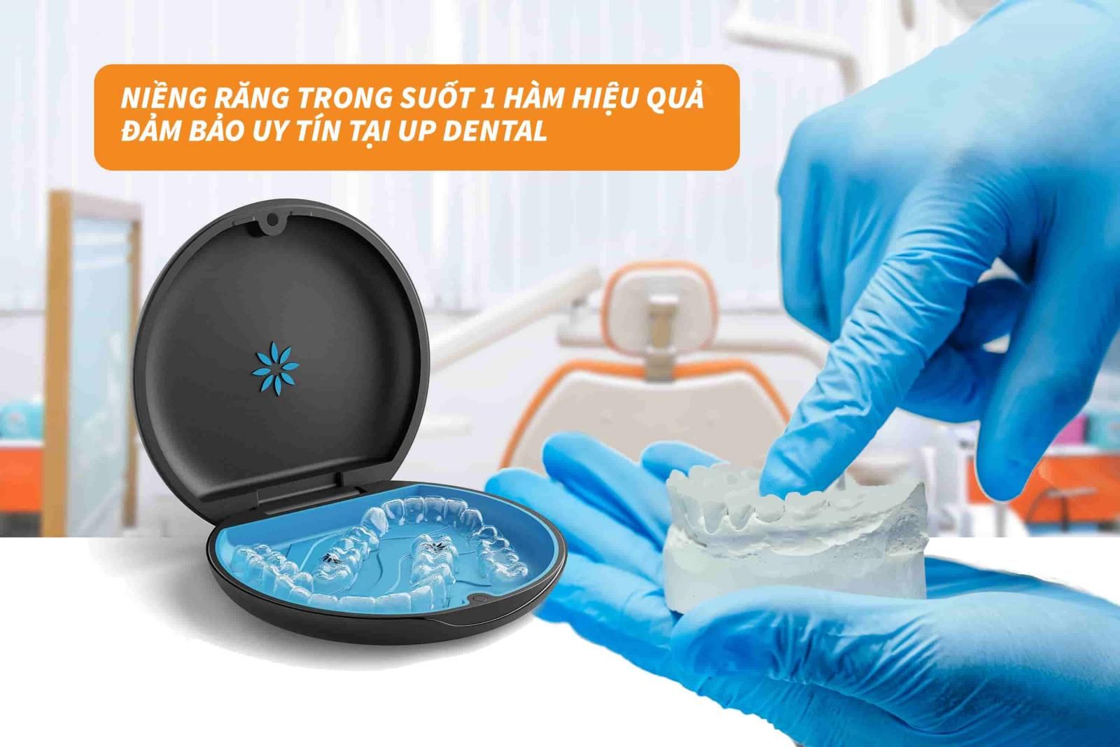 Niềng răng trong suốt 1 hàm hiệu quả, đảm bảo uy tín tại Up Dental