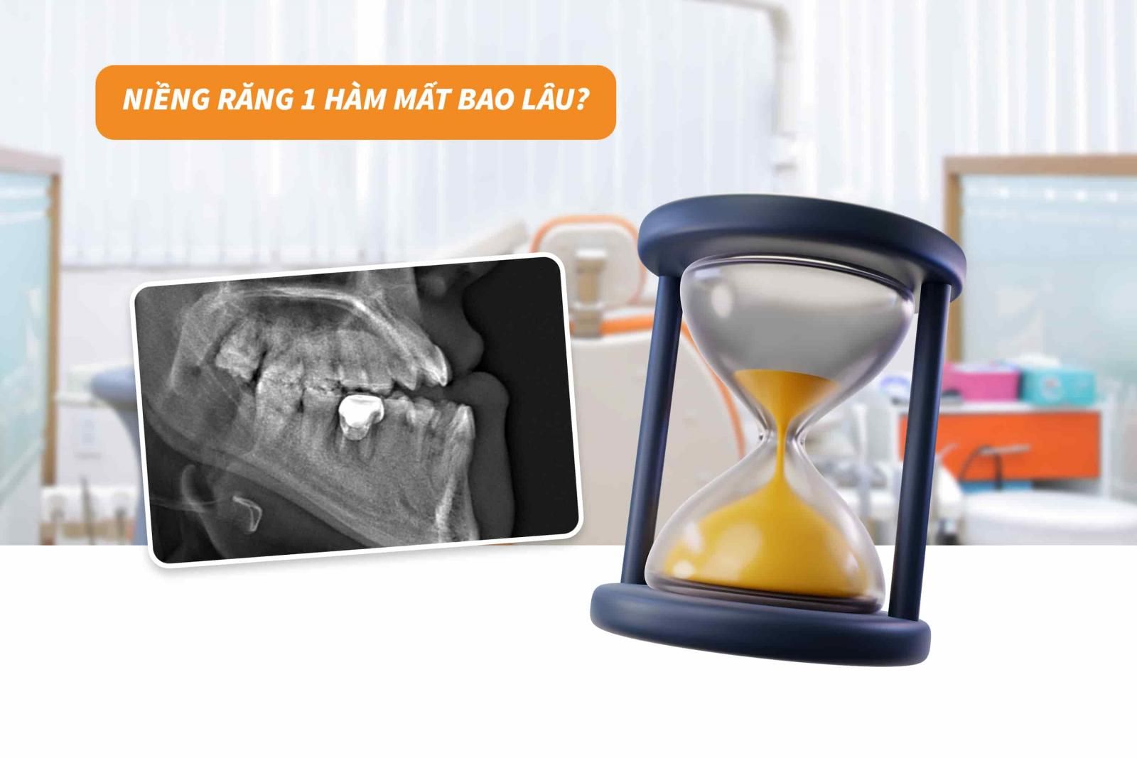 Niềng răng trong suốt 1 hàm mất bao lâu?