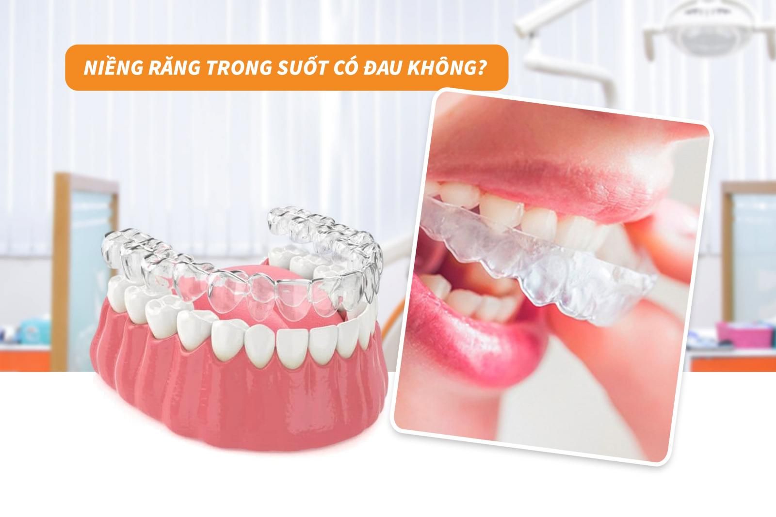 Niềng răng trong suốt đau không?