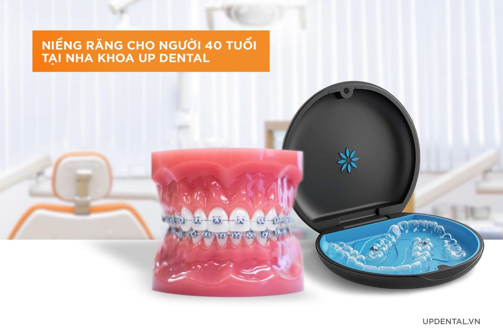 Niềng răng tuổi 40 ở Up Dental