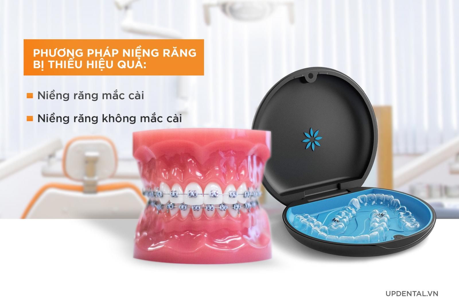 3 phương pháp niềng răng khi bị thiếu răng