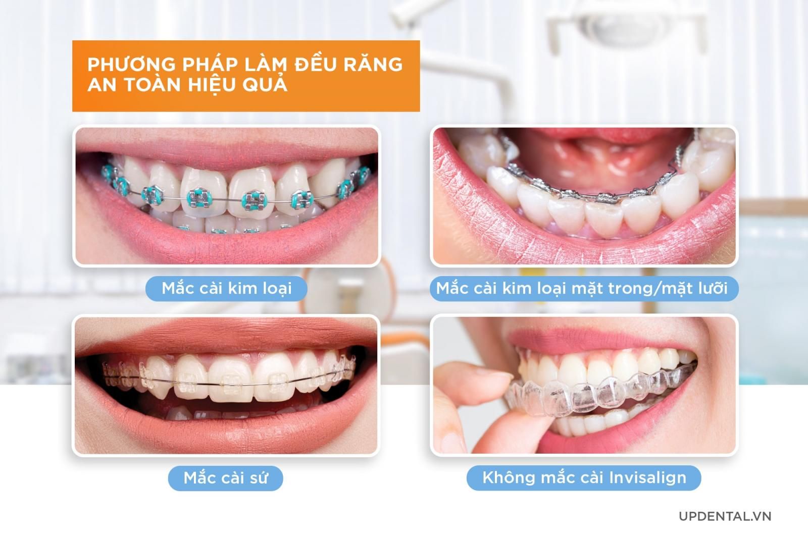 Phương pháp làm đều răng hiệu quả