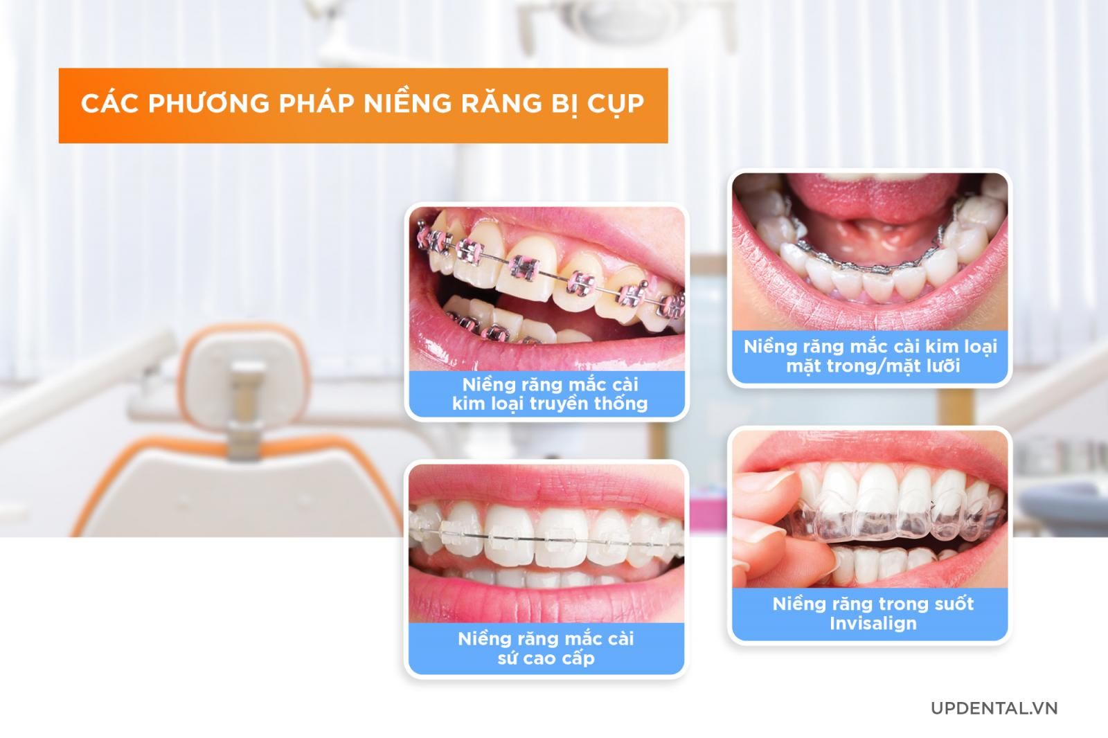 Các phương pháp niềng răng bị cụp