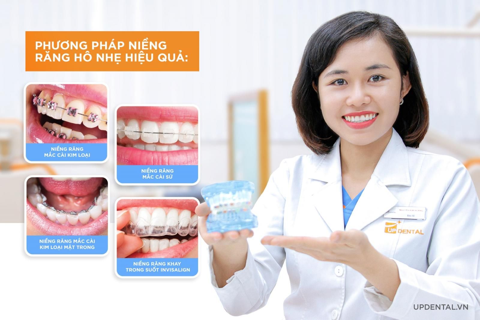 Phương pháp niềng răng hô nhẹ