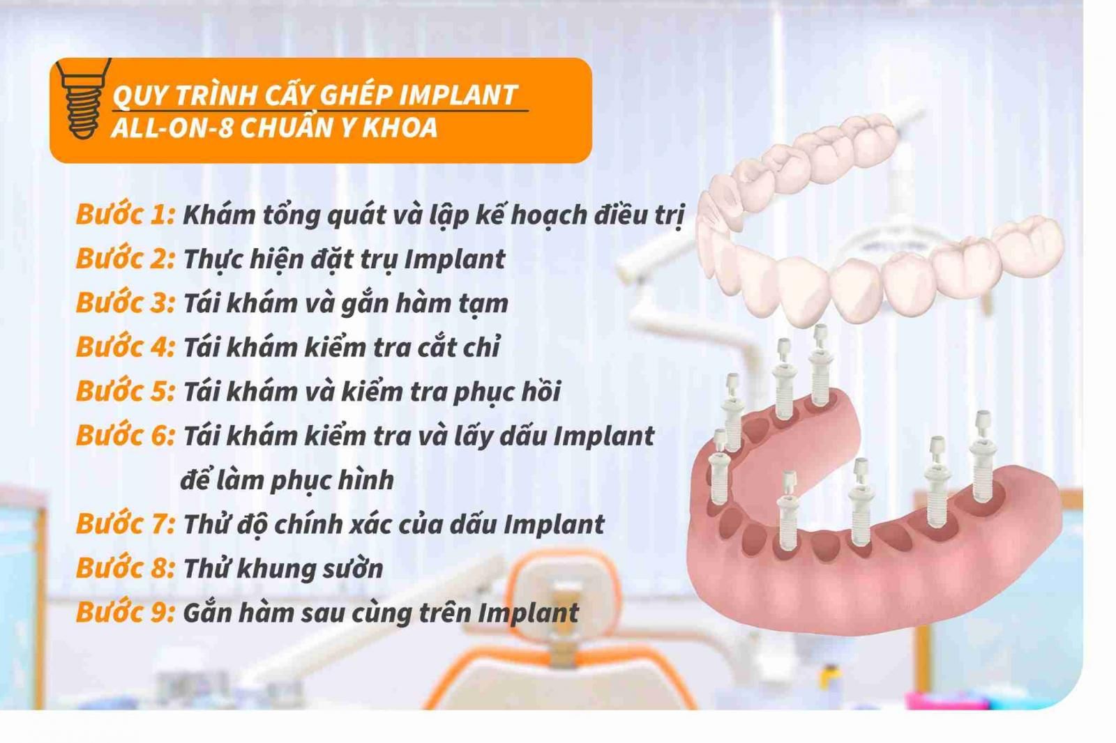 Quy trình cấy ghép implant All-on-8 chuẩn Y khoa