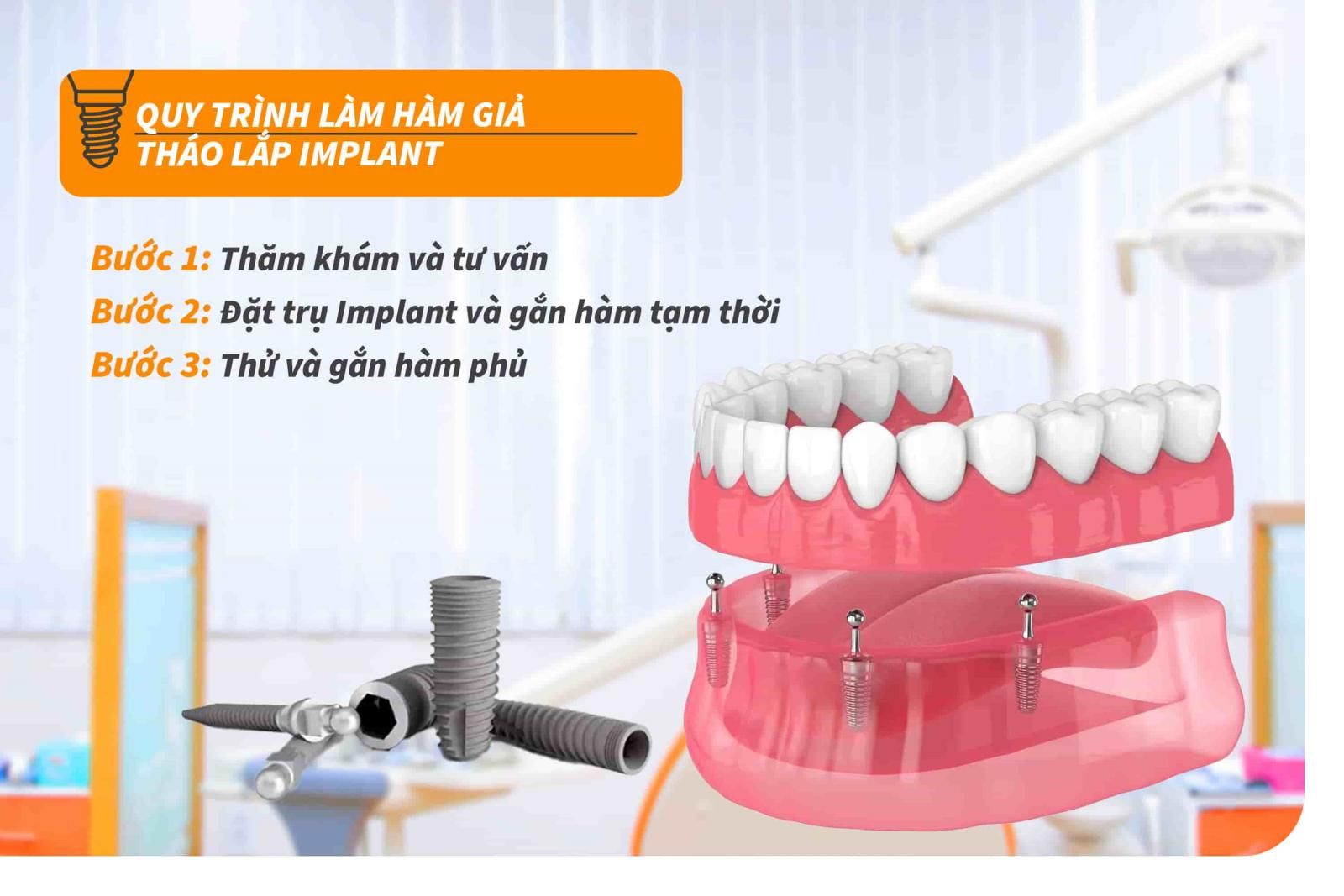 Quy trình làm hàm giả tháo lắp Implant 