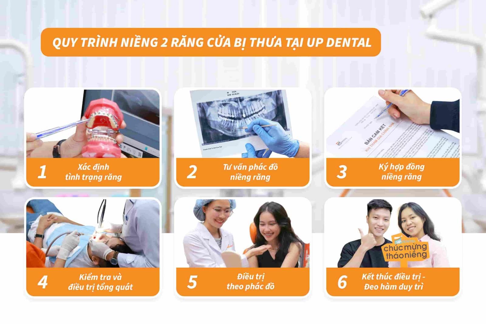 Quy trình niềng 2 răng cửa bị thưa tại Up Dental 