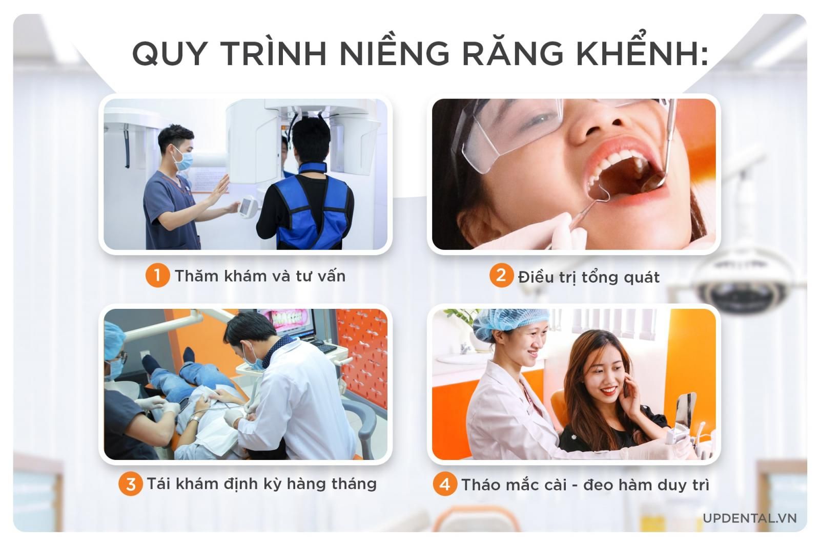 quy trình niềng răng khểnh chuẩn y khoa