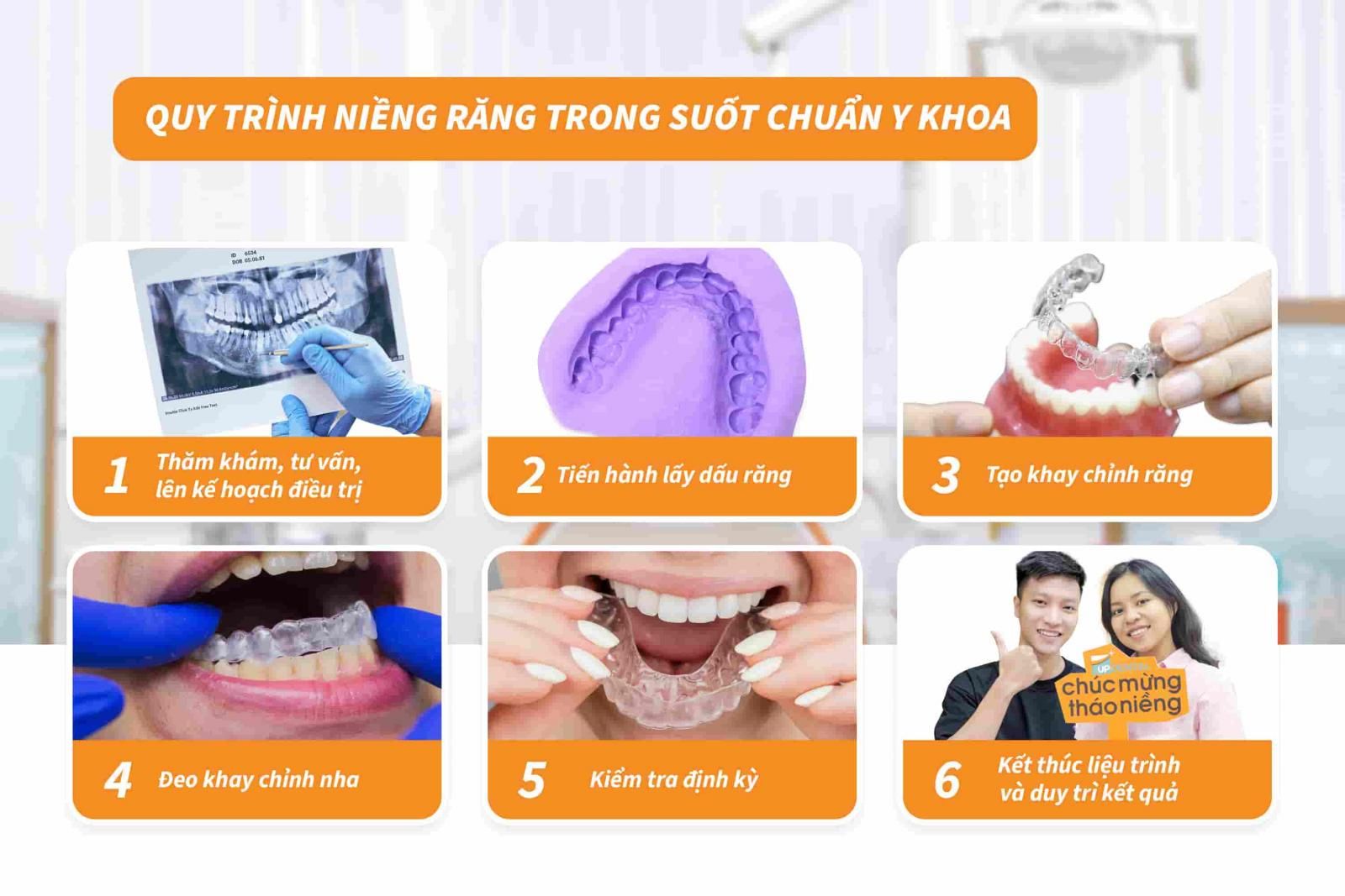 Quy trình niềng răng trong suốt chuẩn Y khoa