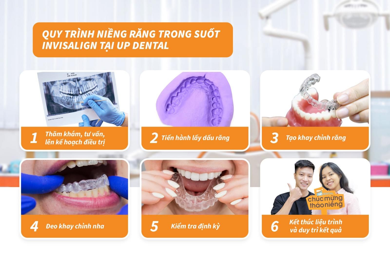 Quy trình niềng răng Invisalign chuẩn Y khoa tại Up Dental