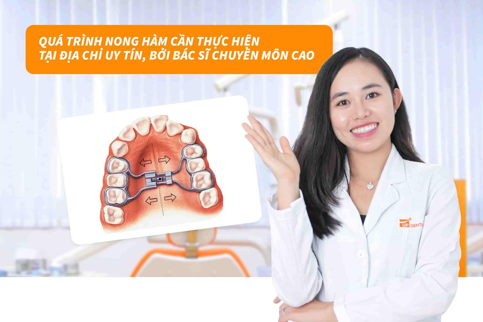 Quy trình nong hàm cần thực hiện tại địa chỉ uy tín