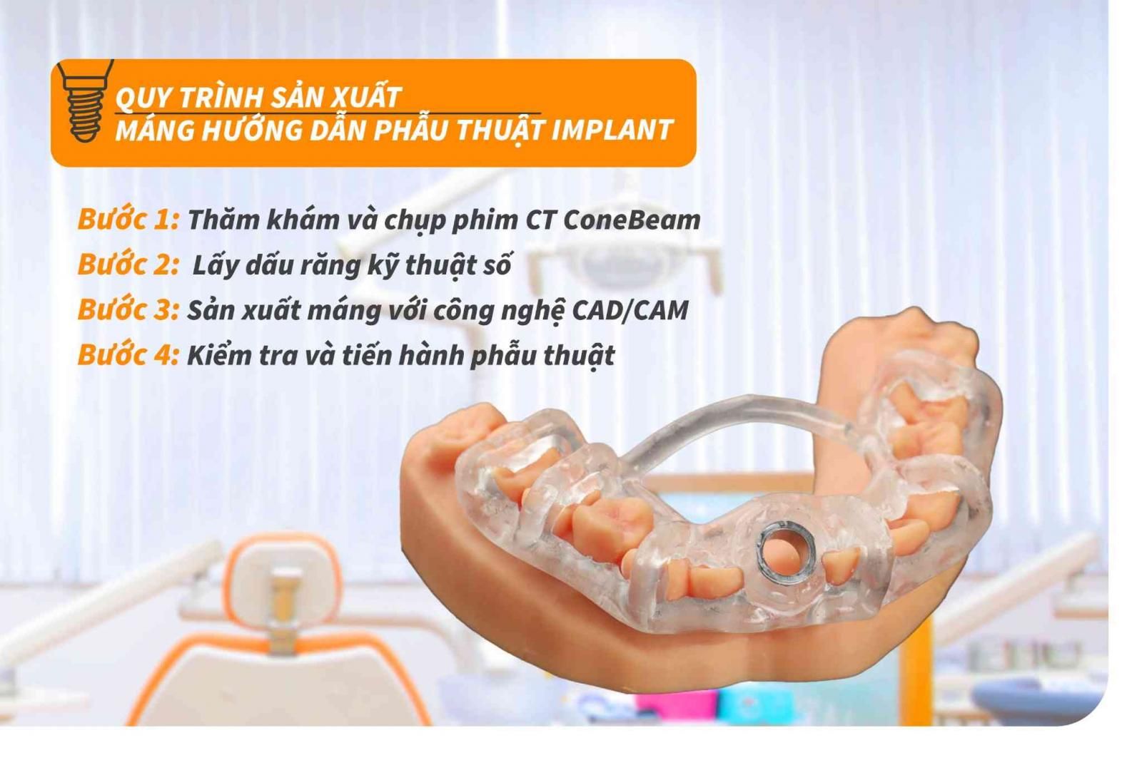 Quy trình sản xuất máng hướng dẫn phẫu thuật Implant 