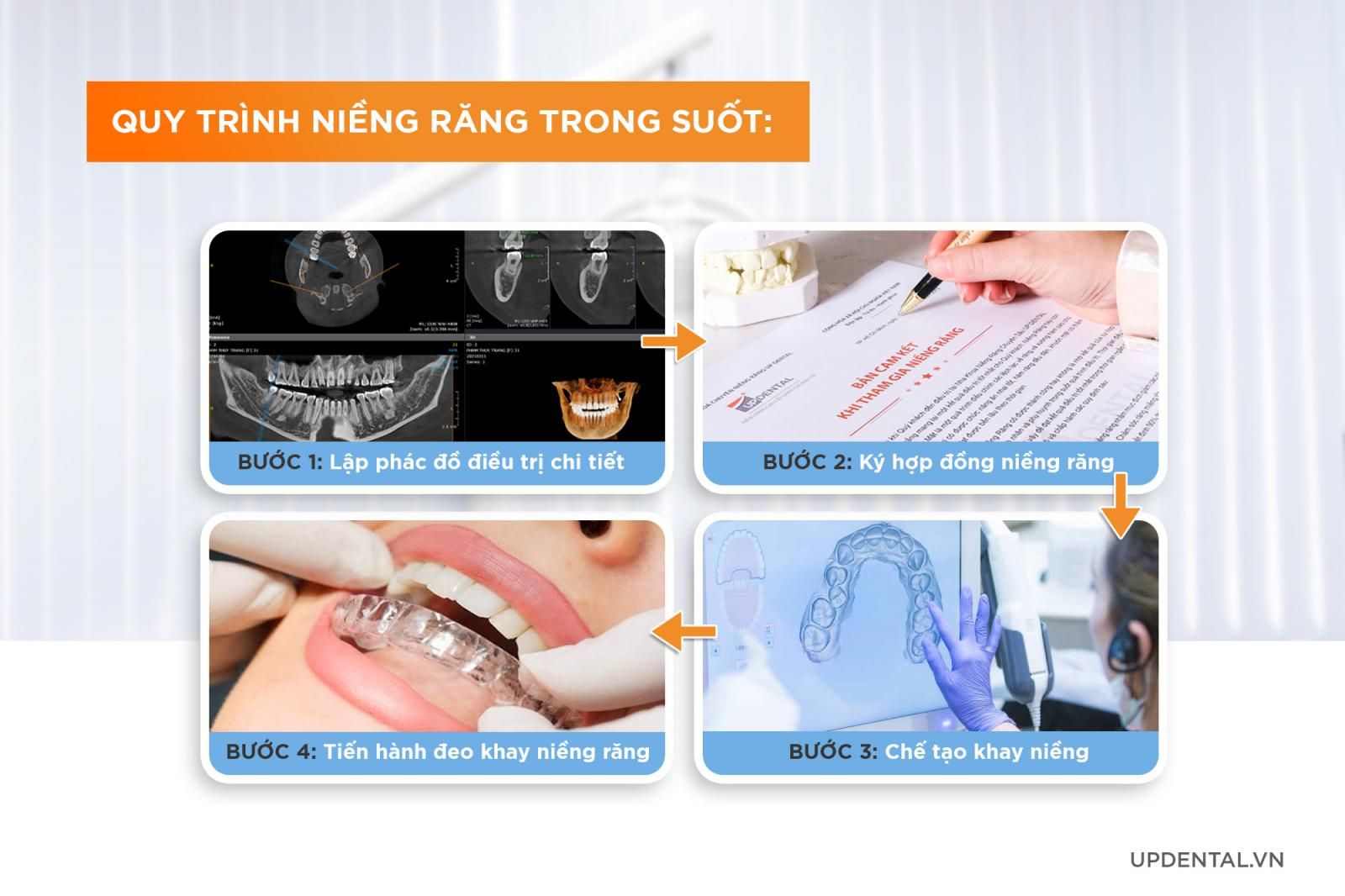 Quy trình niềng răng trong suốt