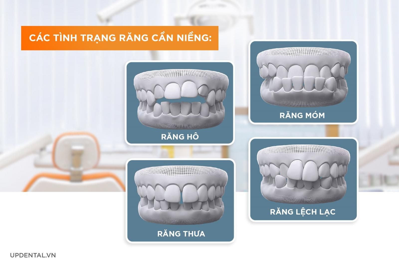 răng như thế nào thì nên niềng