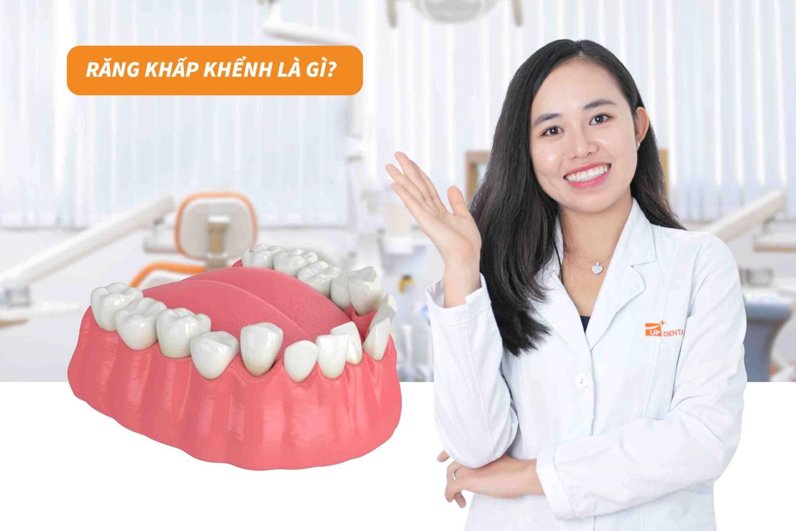 Răng khấp khểnh là gì? 