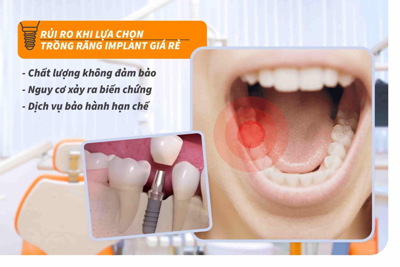 Rủi ro khi trồng răng Implant giá rẻ