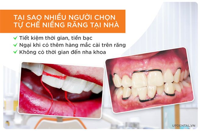 tại sao nhiều người tự chế niềng răng