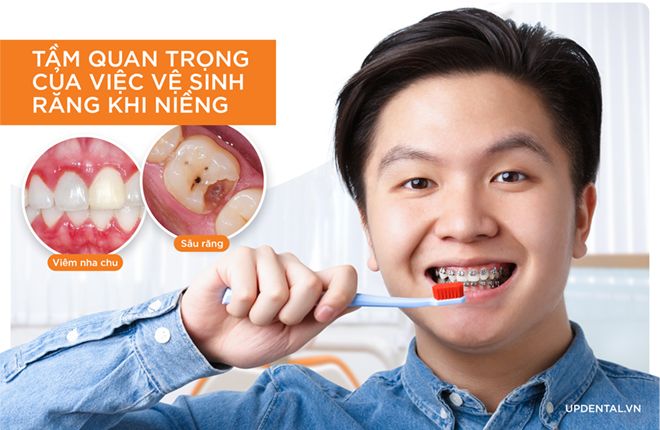 tầm quan trọng của vệ sinh răng miệng