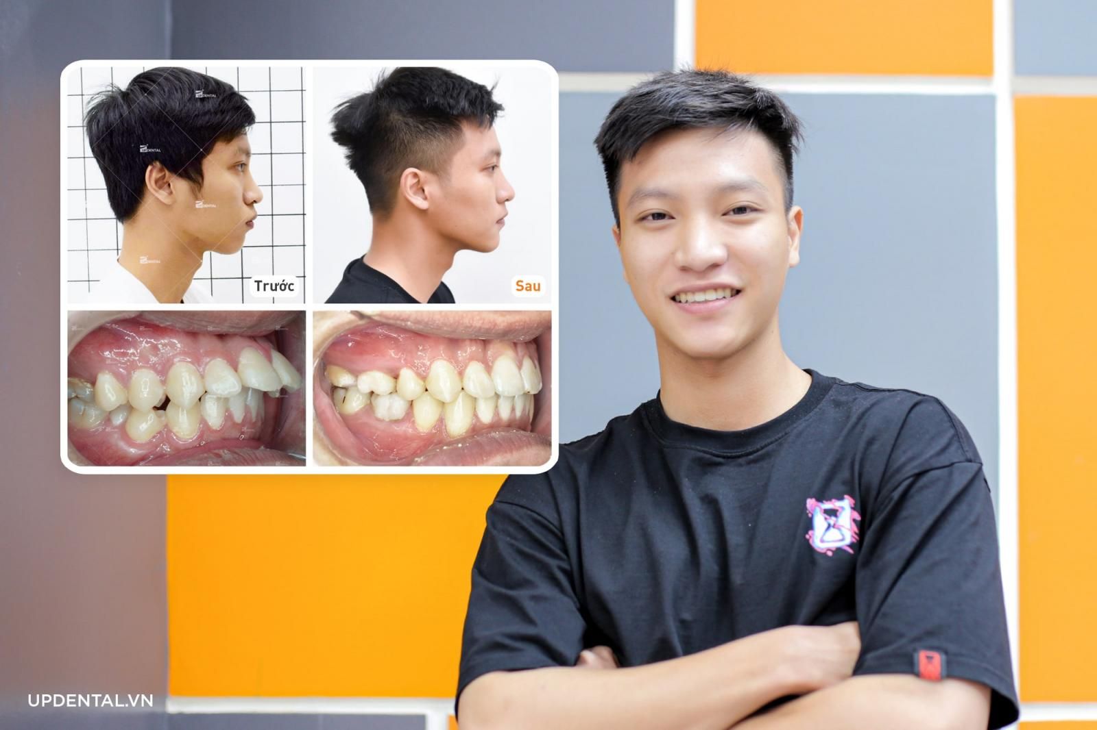 Thay đổi góc nghiêng Thế Truyền