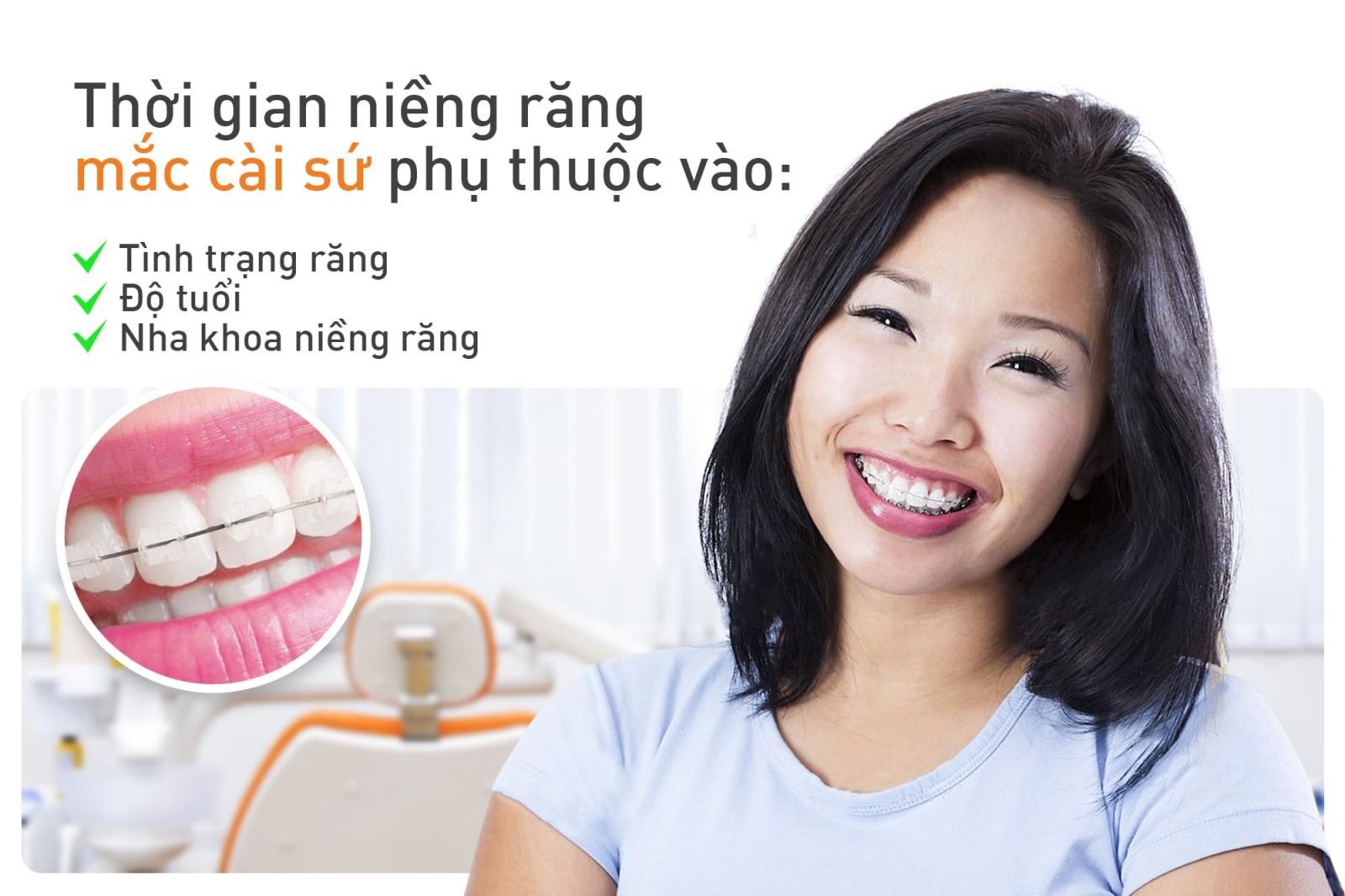 thời gian niềng răng mắc cài sứ dây trong