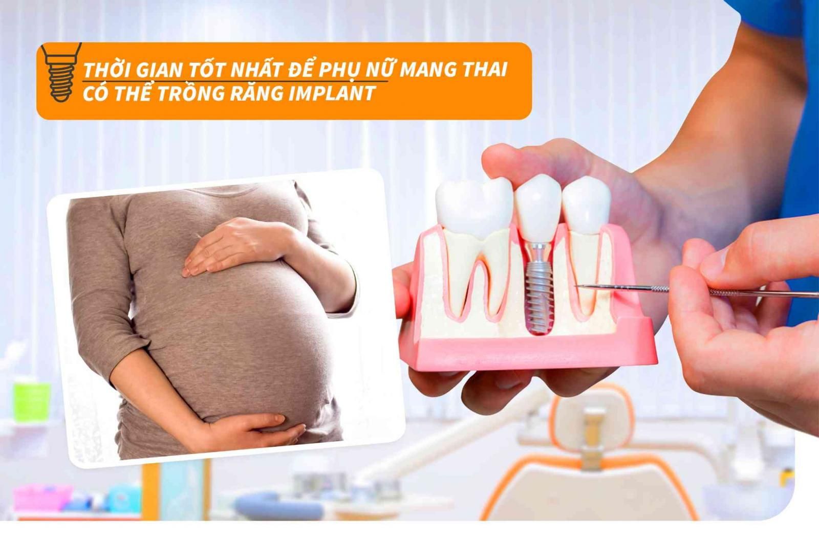 Thời gian tốt nhất để phụ nữ mang thai có thể trồng răng Implant