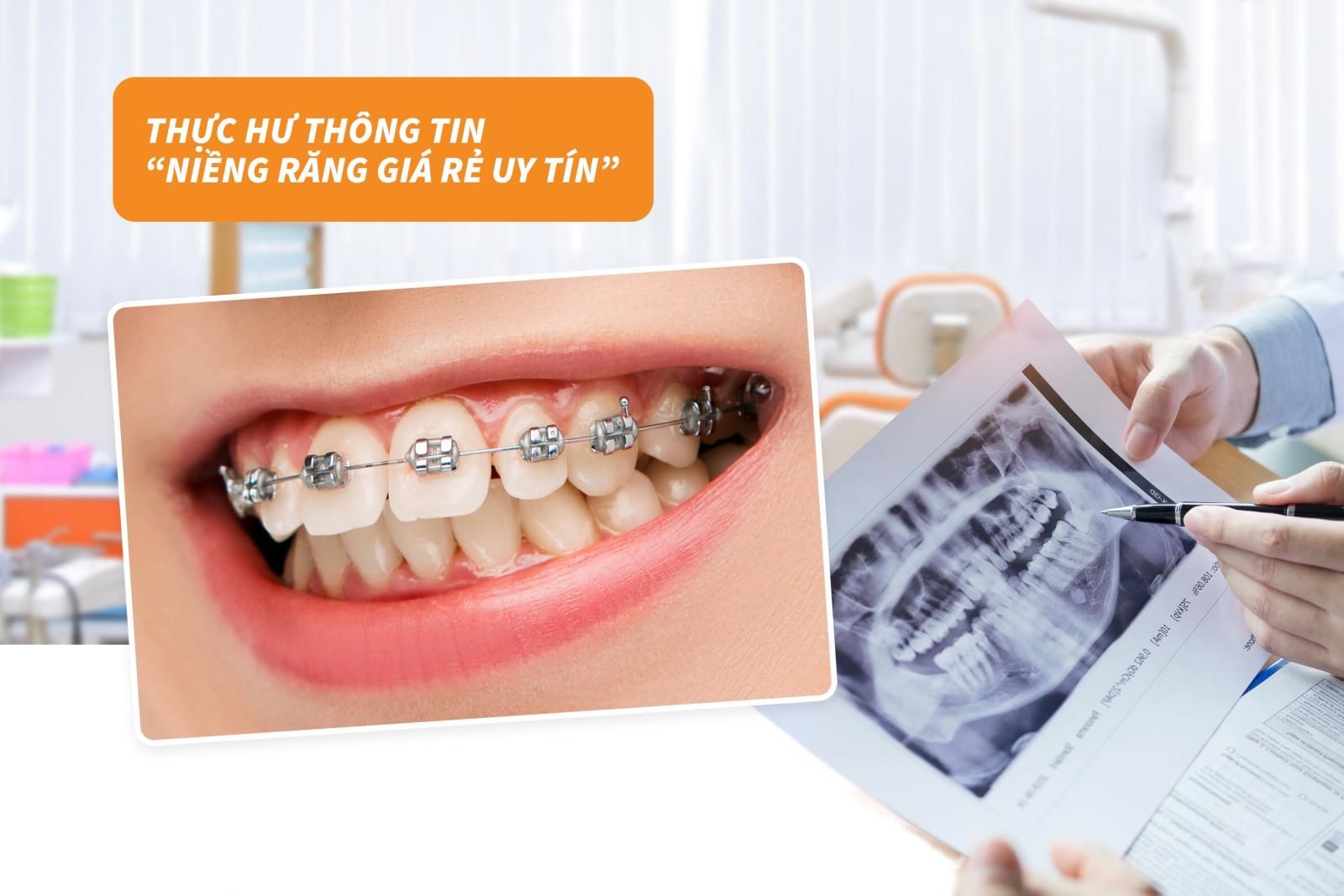 Thực hư thông tin về niềng răng giá rẻ uy tín