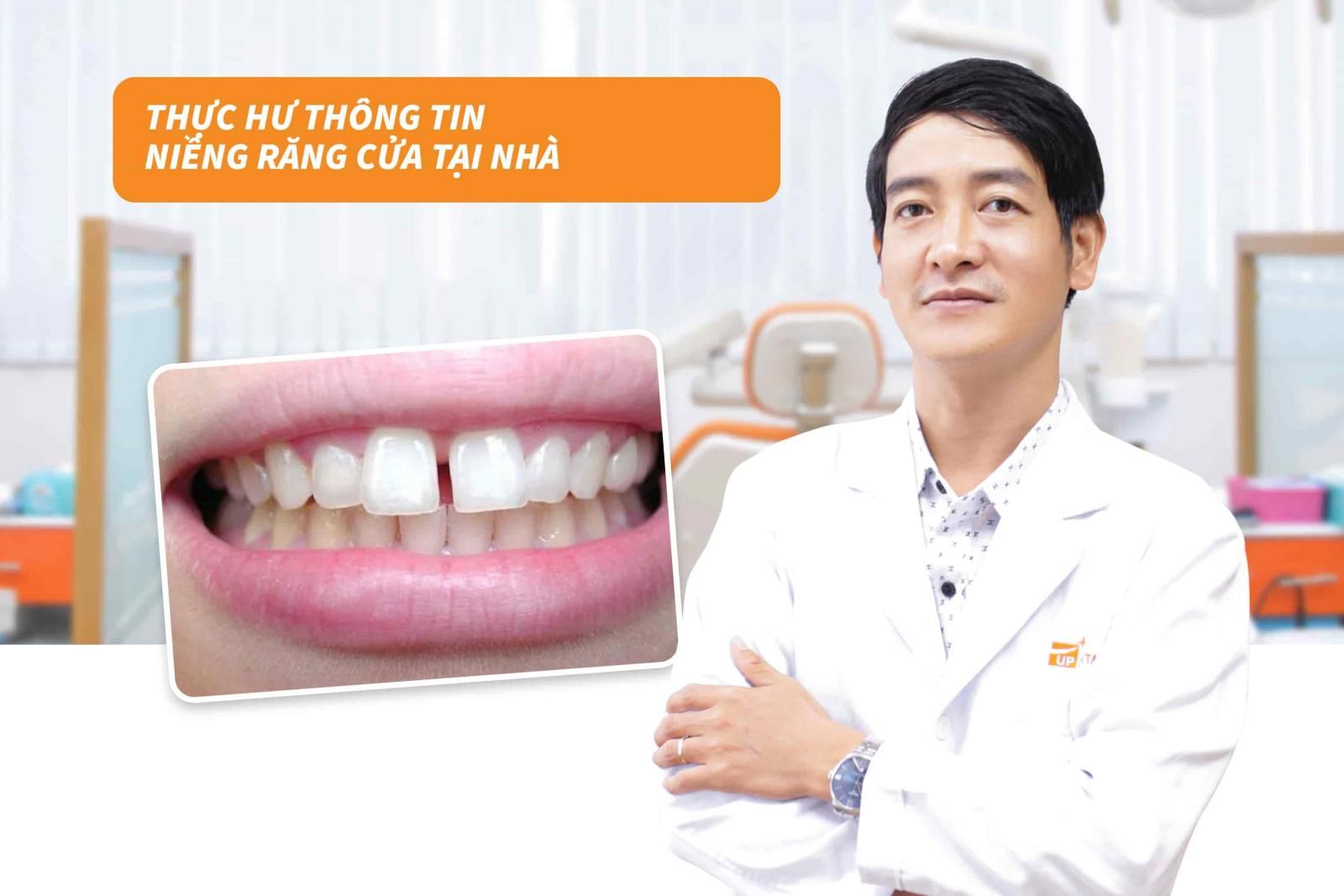 Thực hư thông tin niềng răng cửa tại nhà