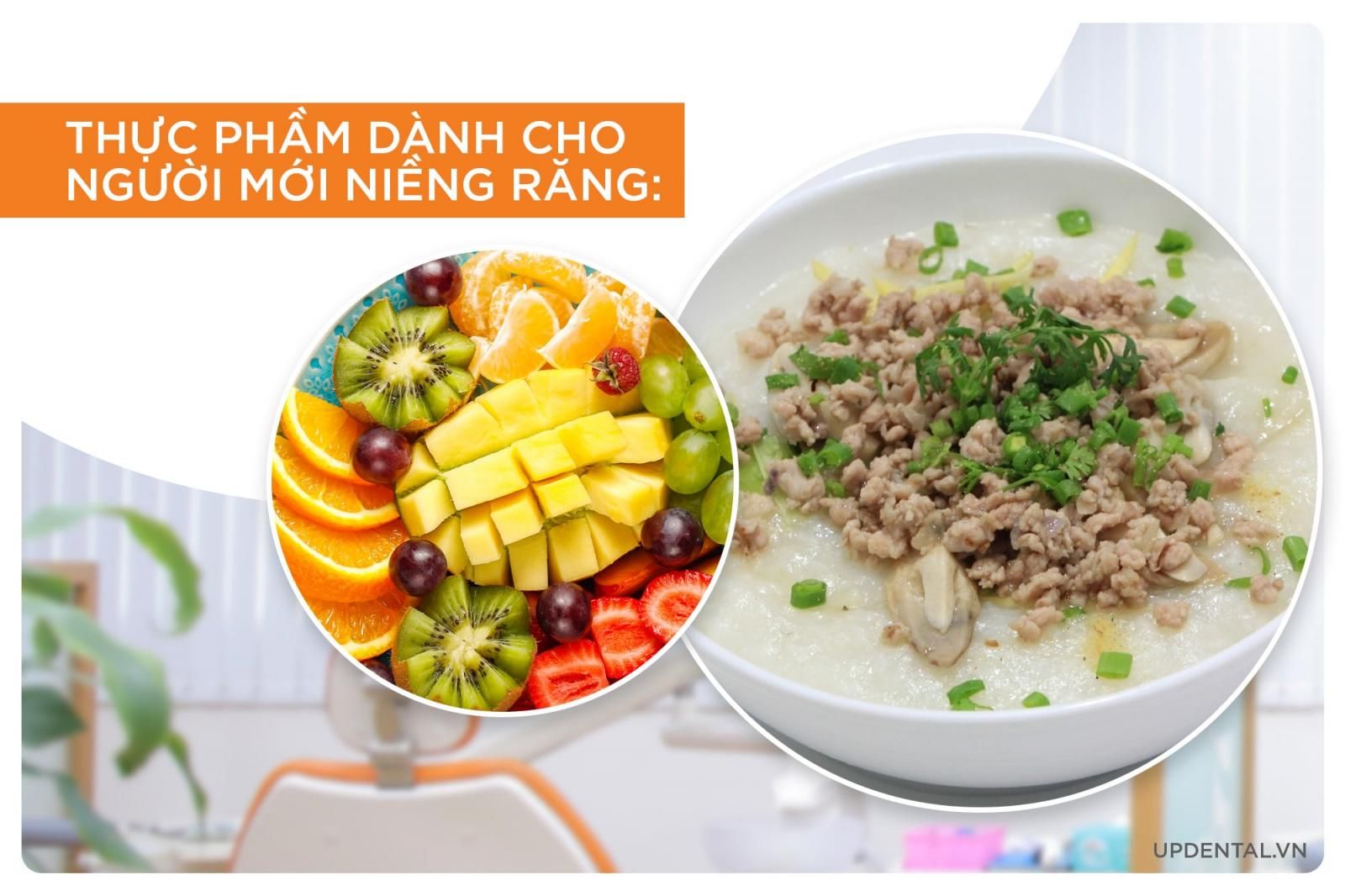 thực phẩm dành cho người mới niềng răng