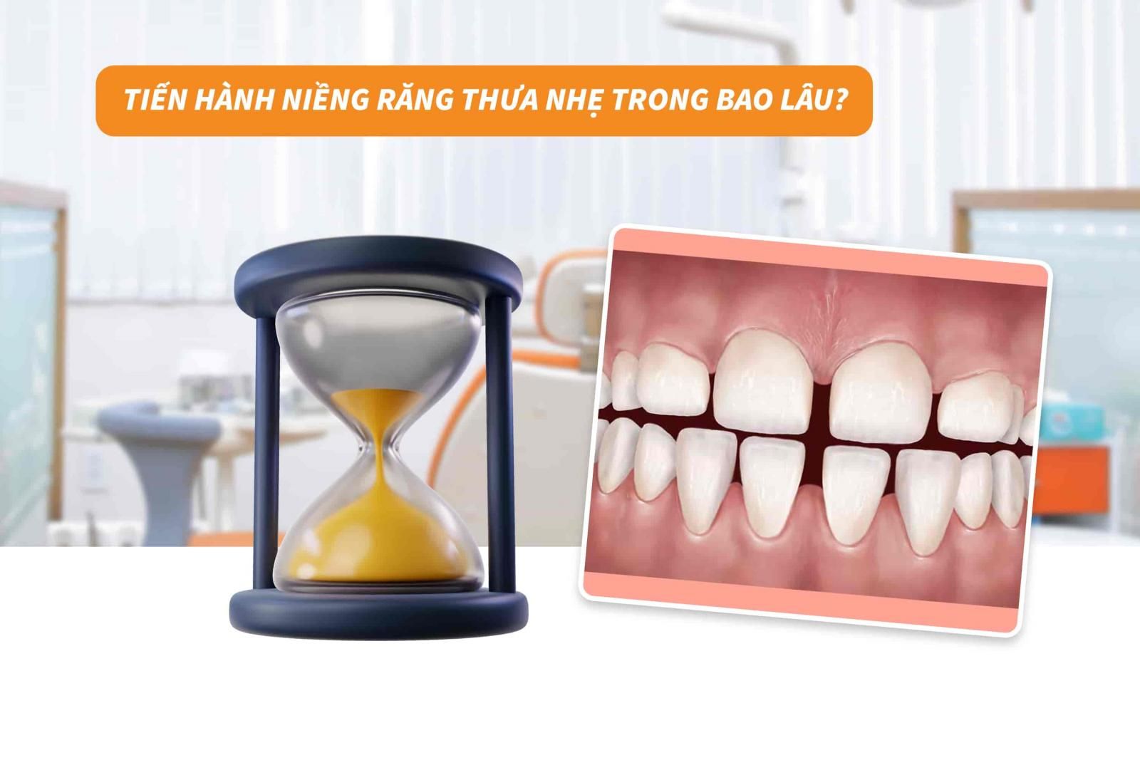 Tiến hành niềng răng thưa nhẹ trong bao lâu