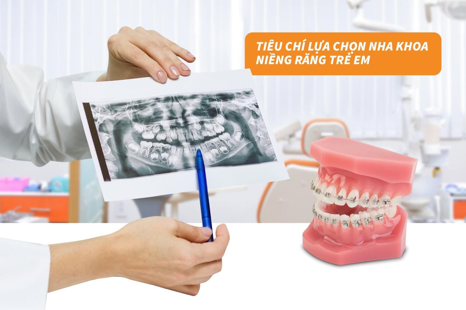 Tiêu chí lựa chọn nha khoa niềng răng trẻ em 