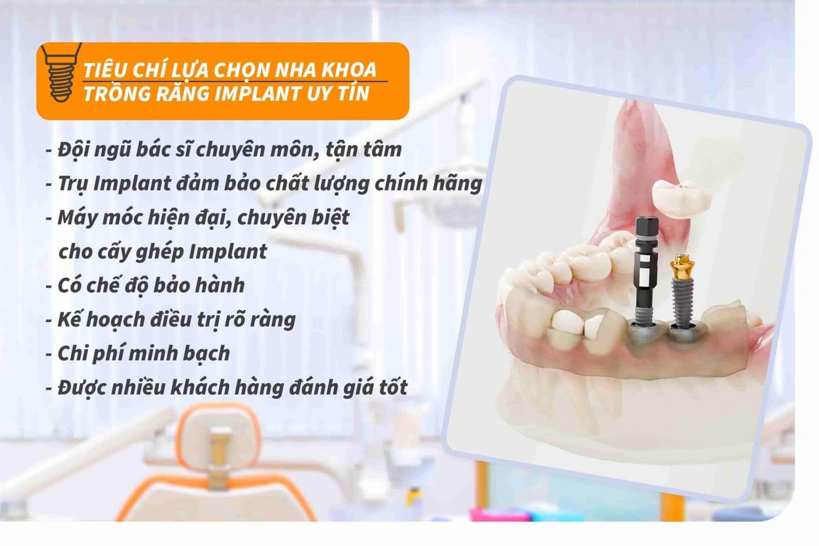 7 tiêu chí lựa chọn nha khoa trồng răng Implant uy tín