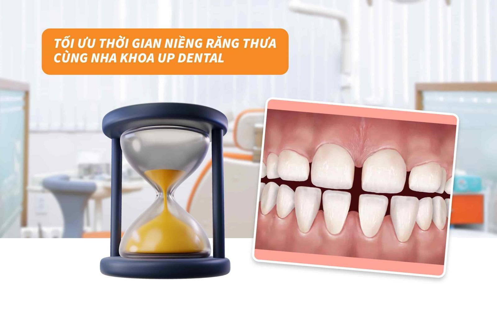 Tối ưu thời gian niềng răng thưa cùng nha khoa Up Dental 