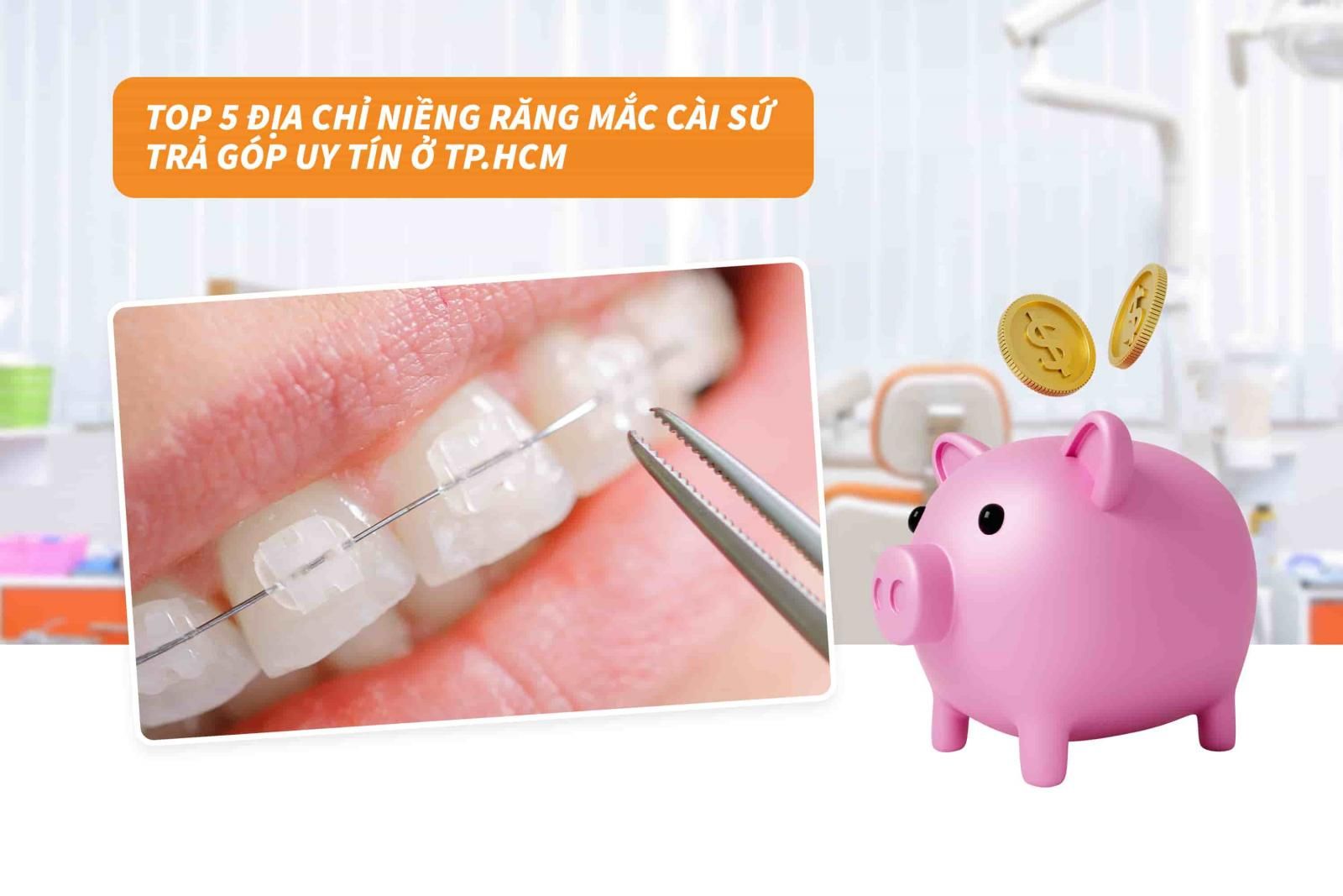 Top 5 địa chỉ niềng răng mắc cài sứ uy tín ở Hồ Chí Minh