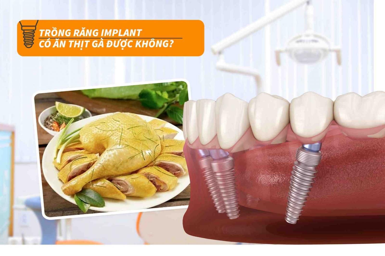 Trồng răng Implant có ăn thịt gà được không?