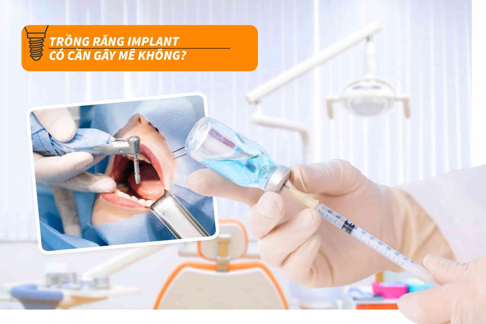 Trồng răng Implant có cần gây mê không?