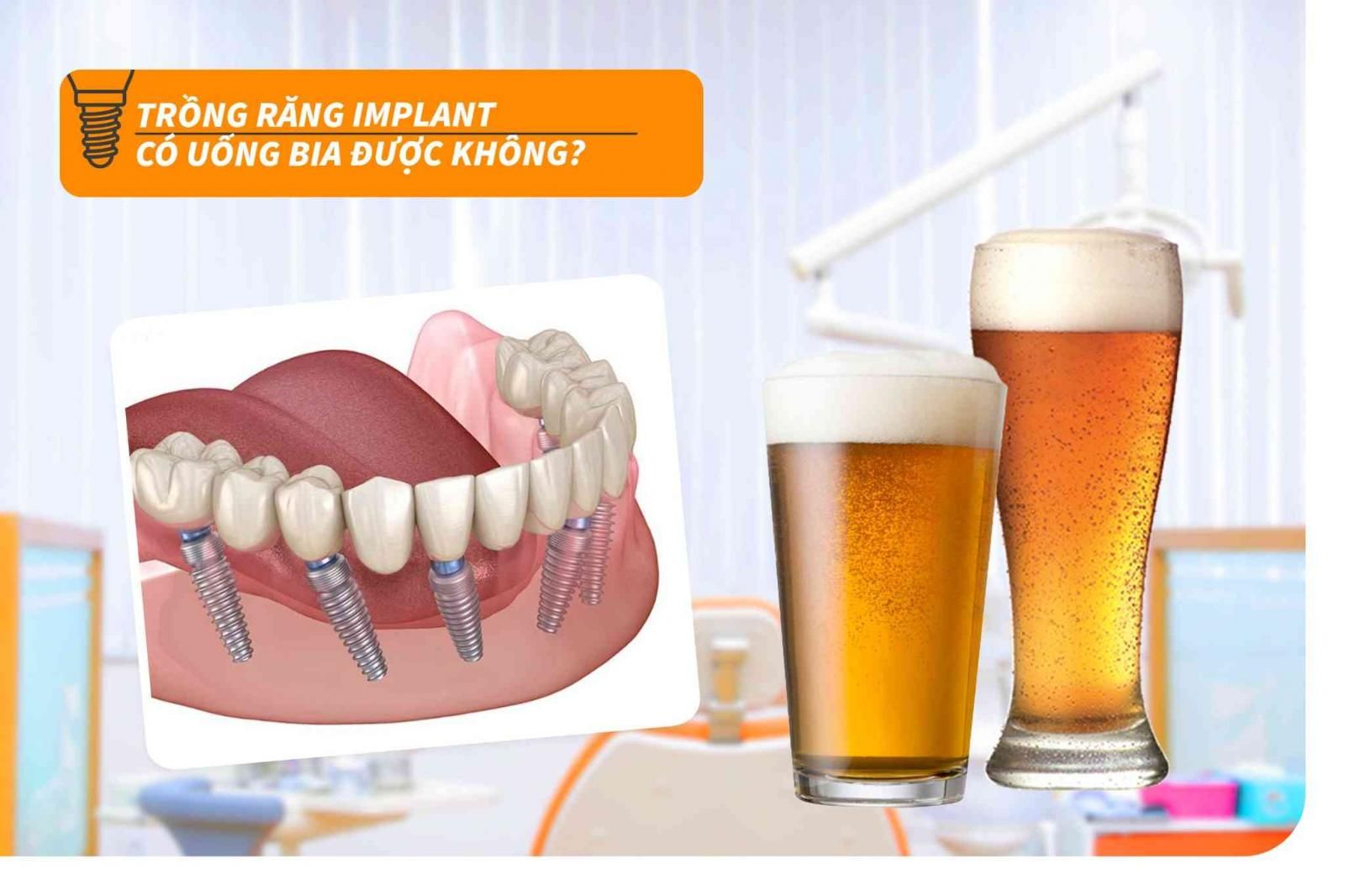 Trồng răng Implant có uống bia được không?