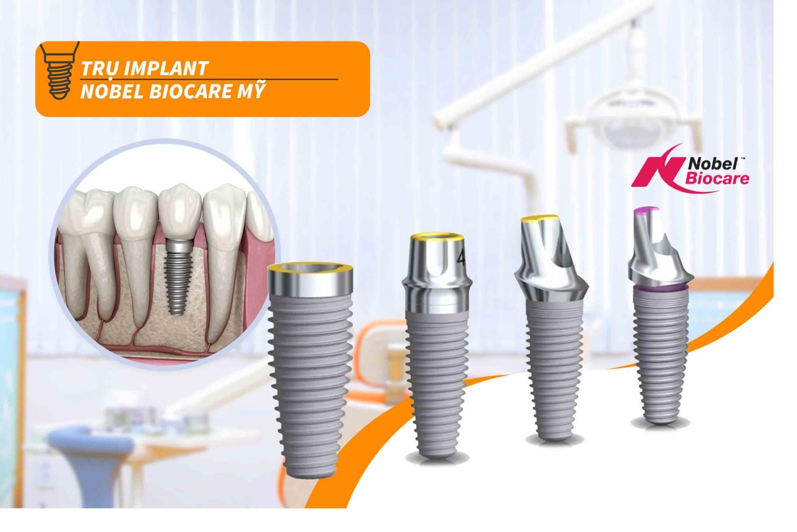 Trụ Implant Nobel Biocare Mỹ