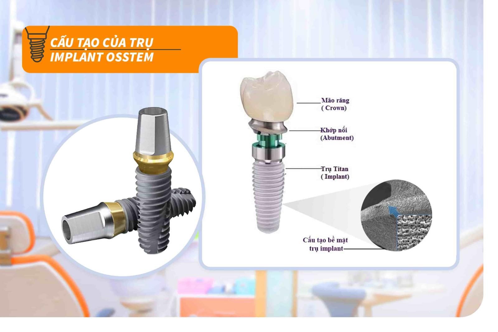 Trụ Implant Osstem có cấu tạo thế nào