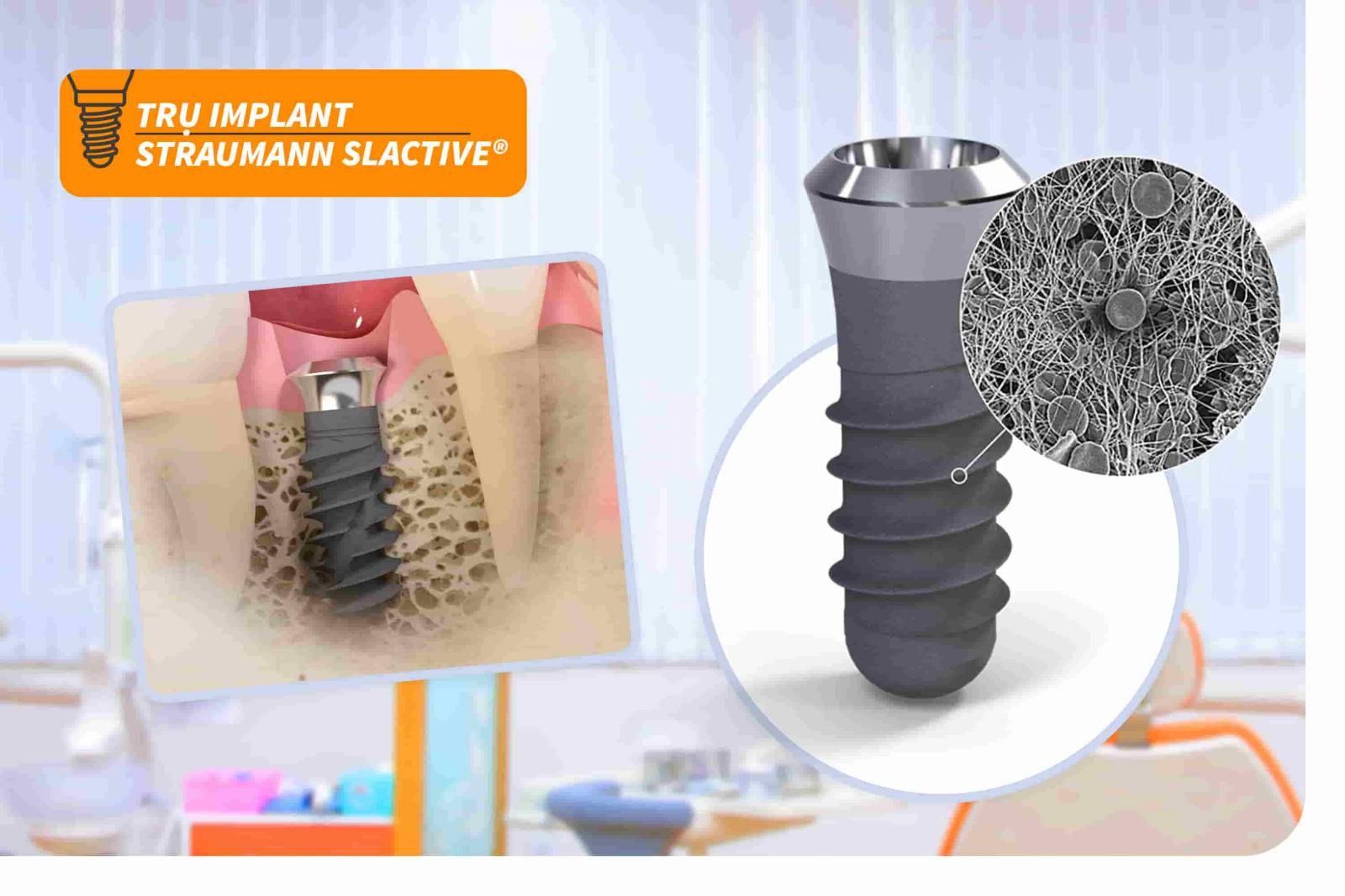 Trụ Implant Straumann SLActive®