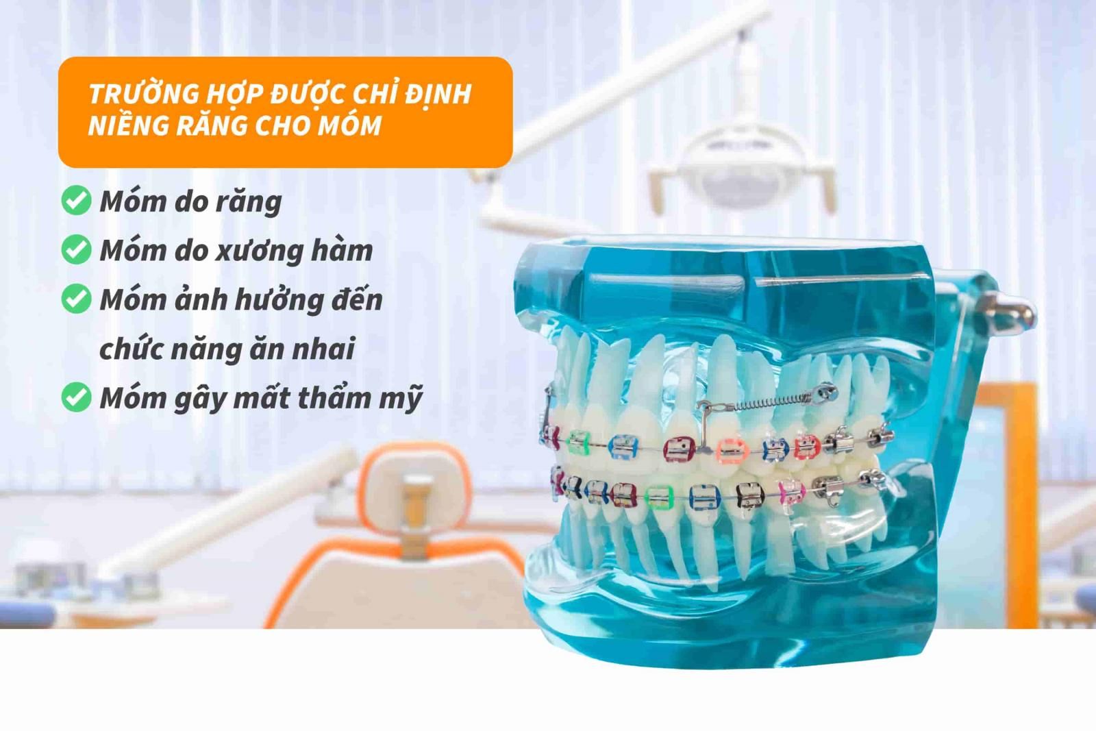 Trường hợp được chỉ định niềng răng cho vấn đề móm