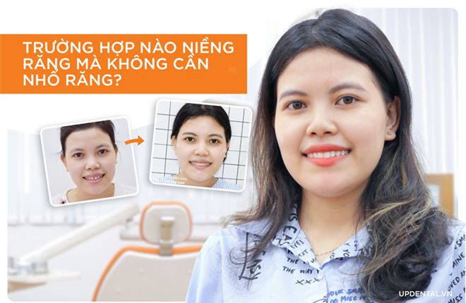 trường hợp nào không cần nhổ răng