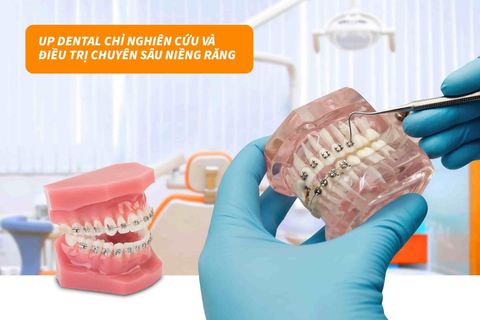 Up Dental chỉ nghiên cứu và điều trị chuyên sâu niềng răng