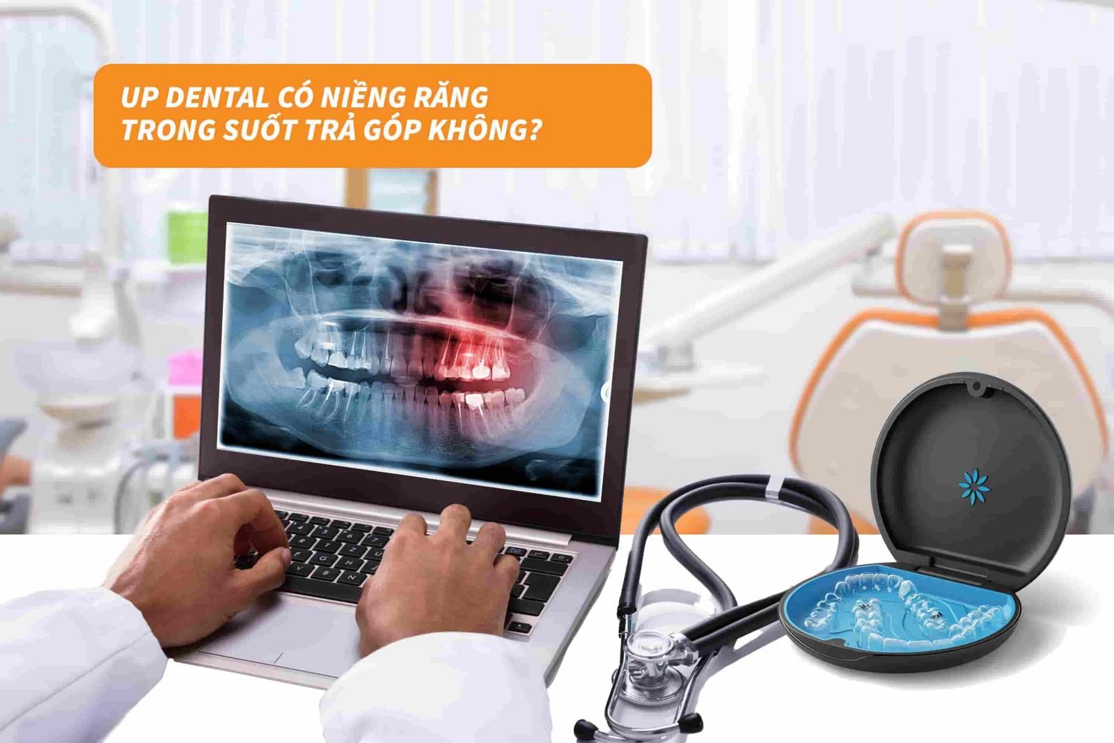 Up Dental có niềng răng trong suốt trả góp không?