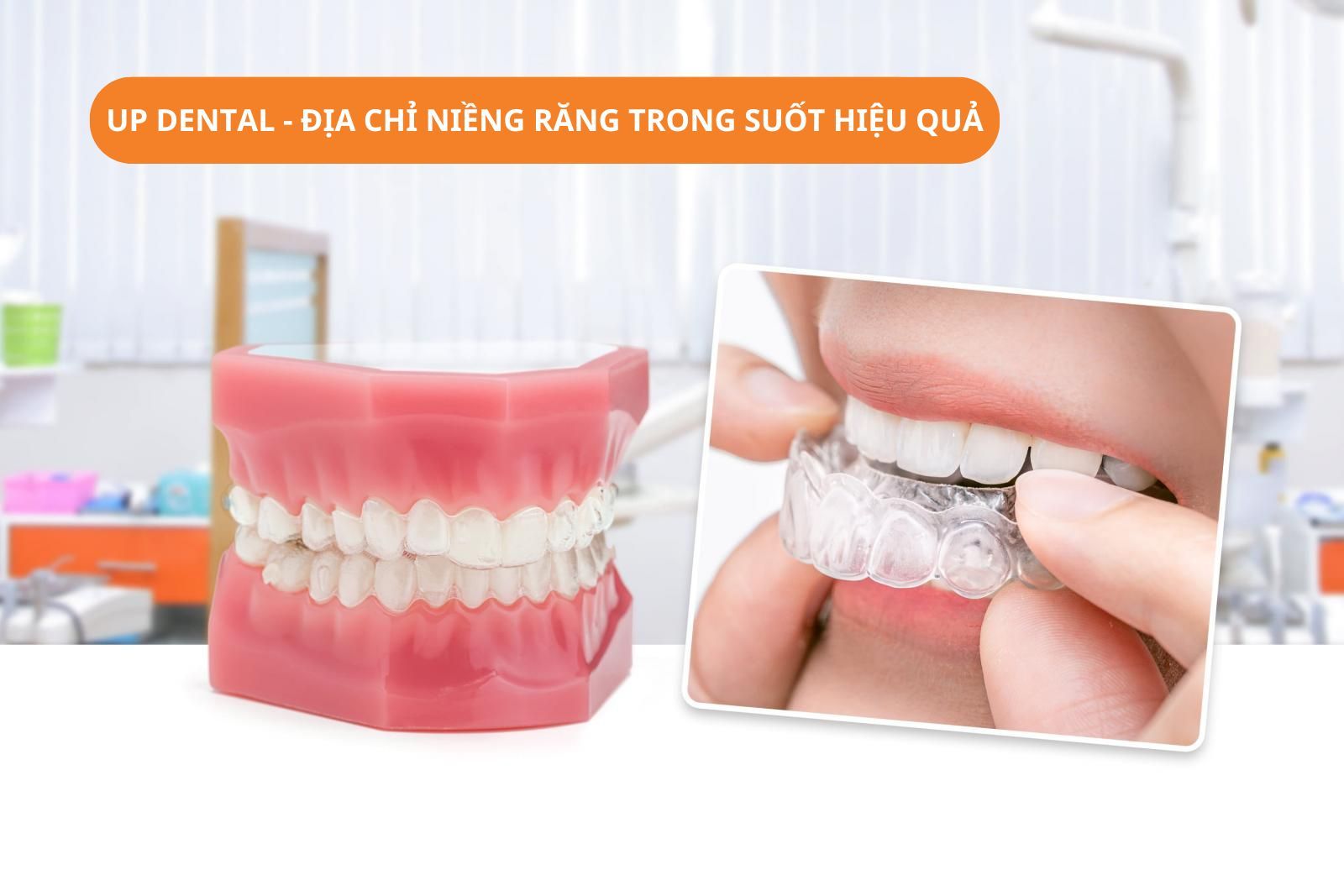 Up Dental - Địa chỉ niềng răng trong suốt hiệu quả