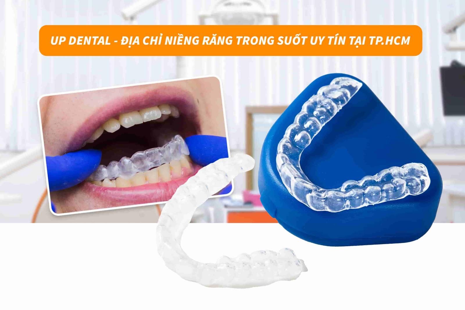 Up Dental - Địa chỉ niềng răng trong suốt uy tín tại TP.HCM