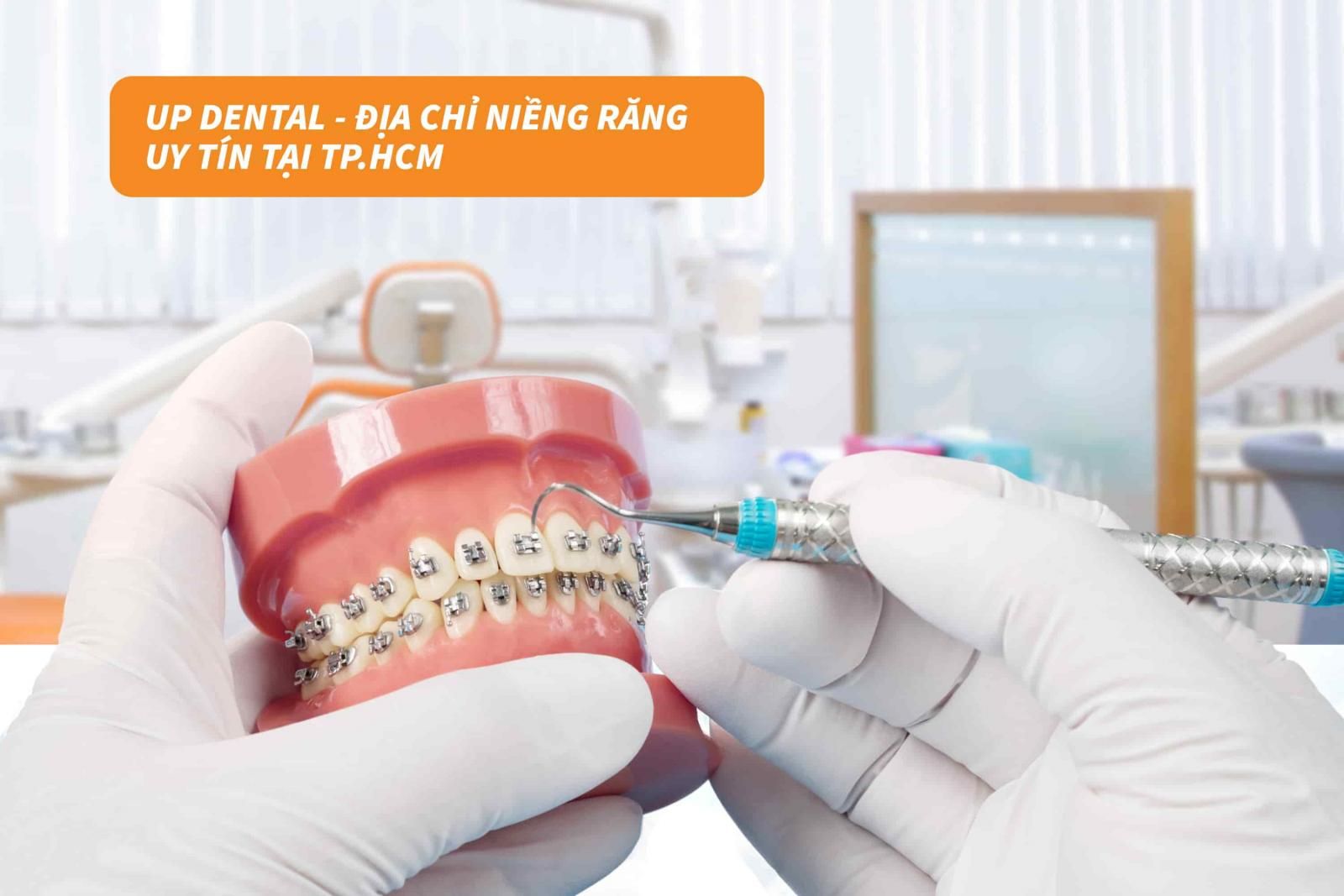 Up Dental - Địa chỉ niềng răng uy tín tại TP.HCM 