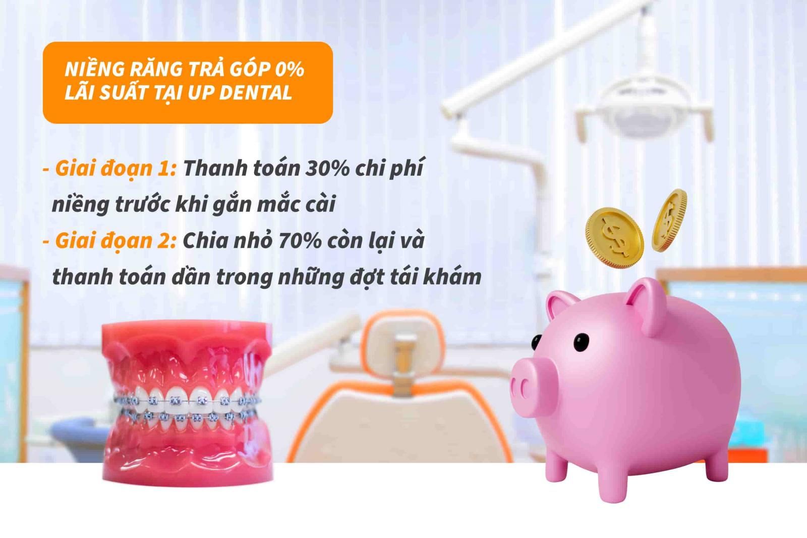 Up Dental có chính sách niềng răng trả chậm